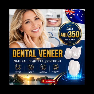 veneers